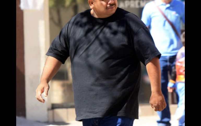El problema de las várices se asocia, entre otros factores, al sobrepeso u obesidad. EL INFORMADOR / ARCHIVO