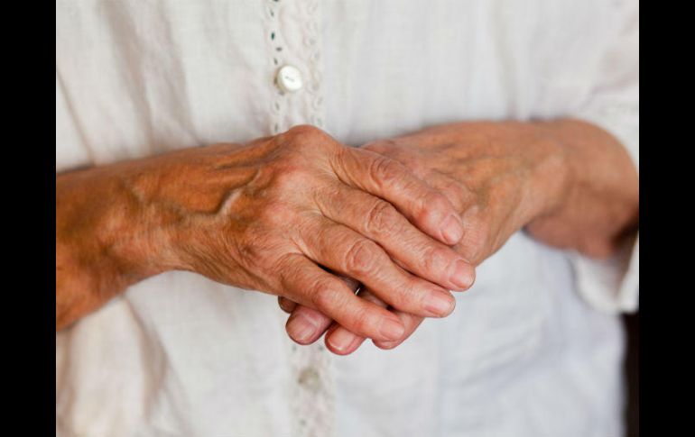 Los primeros rastros de envejecimiento se presentan en las manos. ESPECIAL /